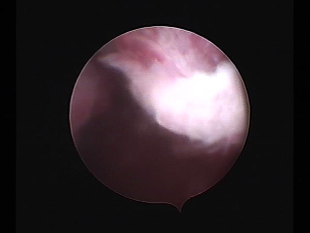 Resectoscopy (2)(14).jpg