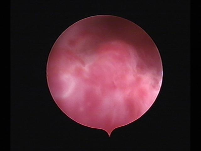 Resectoscopy (2)(19).jpg