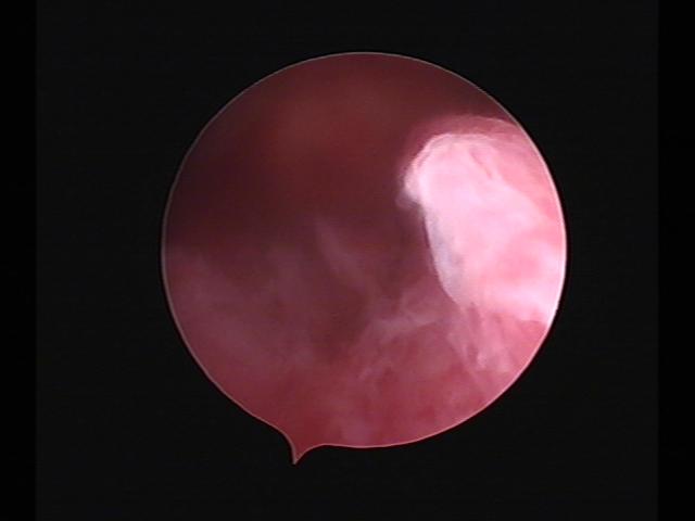 Resectoscopy (2)(20).jpg