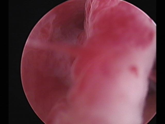 Resectoscopy (2)(21).jpg