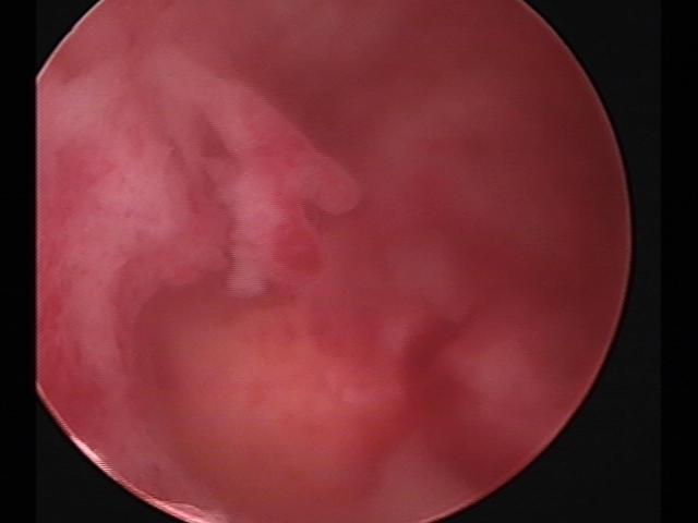 Resectoscopy (2)(22).jpg