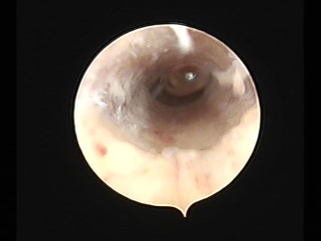 Resectoscopy (2)(23).jpg