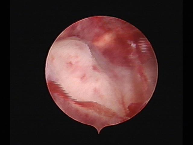 Resectoscopy (2)(27).jpg