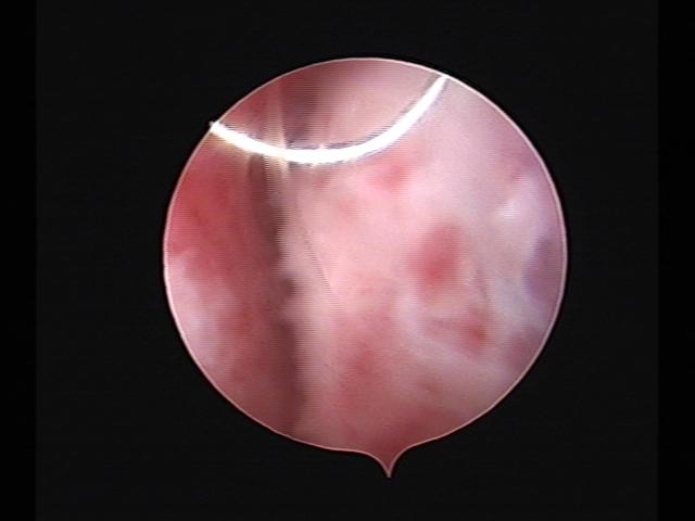 Resectoscopy (2)(40).jpg