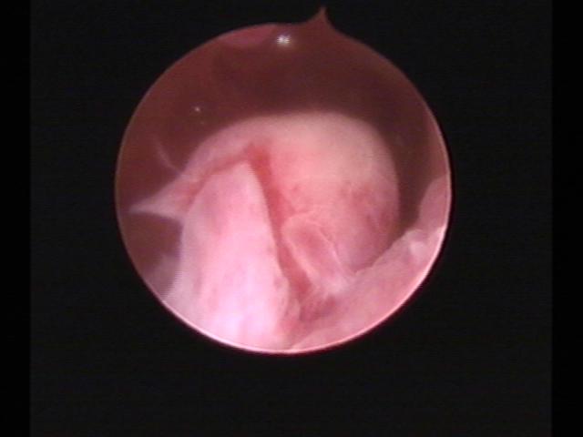 Resectoscopy (2)(47).jpg