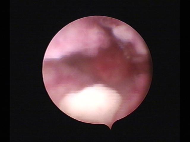 Resectoscopy (3)(10).jpg