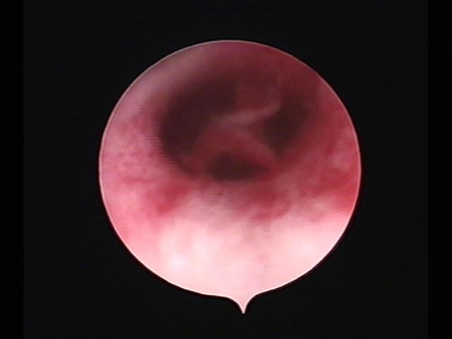 Resectoscopy (3)(18).jpg