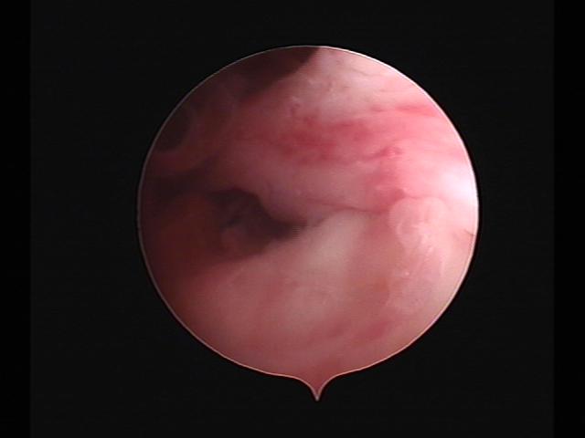 Resectoscopy (3)(20).jpg