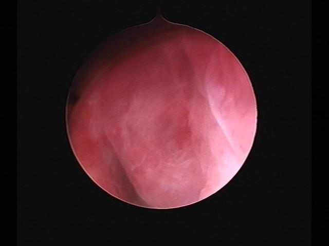 Resectoscopy (3)(29).jpg