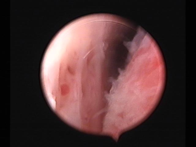 Resectoscopy (3)(31).jpg