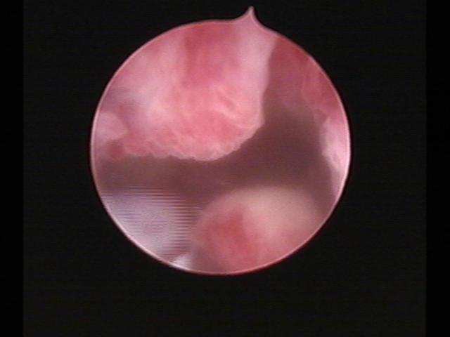 Resectoscopy (3)(34).jpg