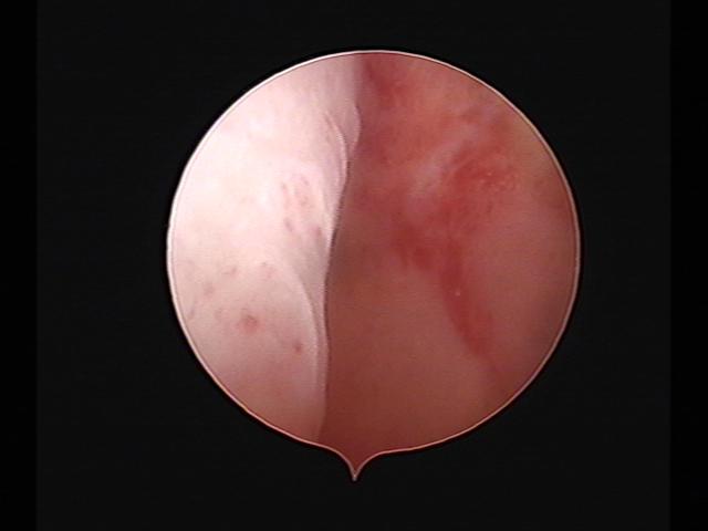 Resectoscopy (4)(18).jpg