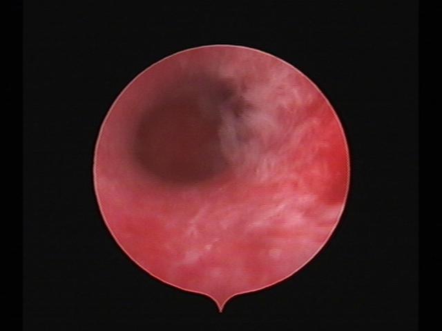 Resectoscopy (4)(19).jpg