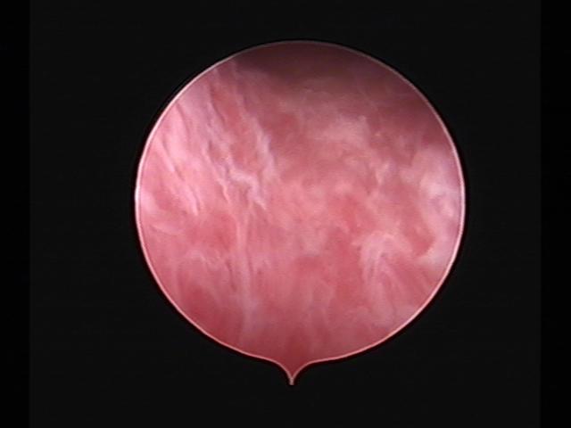 Resectoscopy (4)(22).jpg