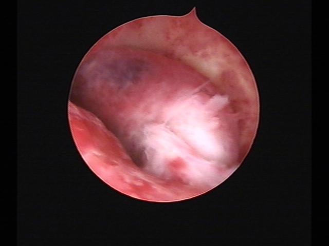 Resectoscopy (4)(24).jpg