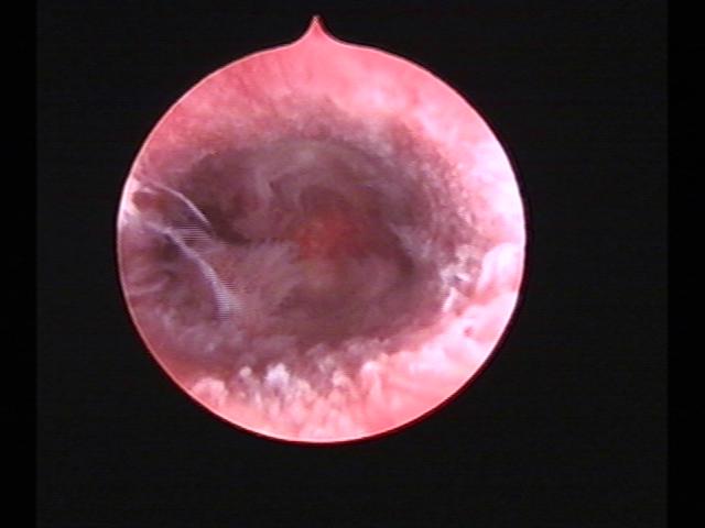 Resectoscopy (4)(25).jpg