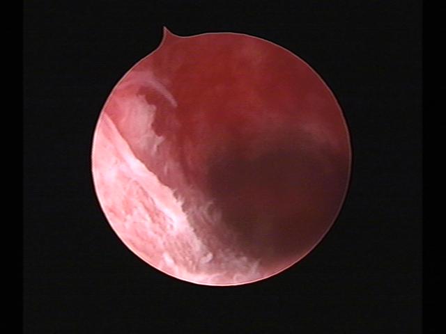 Resectoscopy (4)(26).jpg