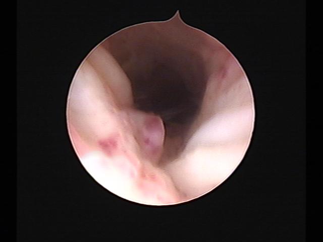 Resectoscopy (4)(27).jpg