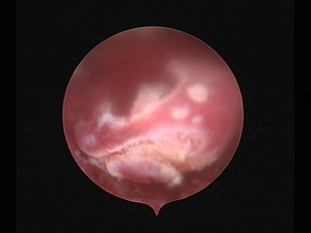 Resectoscopy (5)(10).jpg