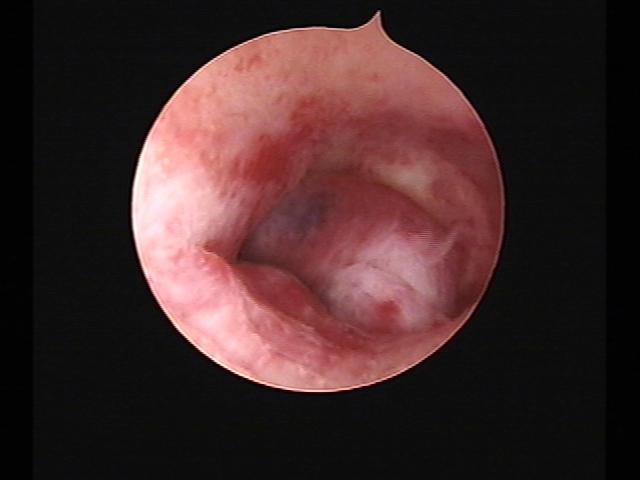 Resectoscopy (5)(11).jpg