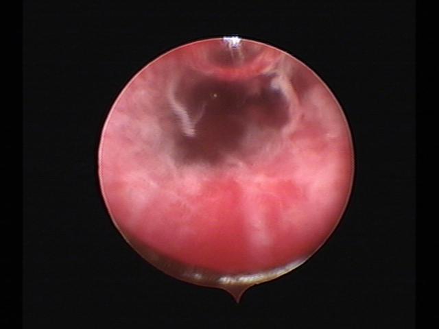 Resectoscopy (5)(2).jpg