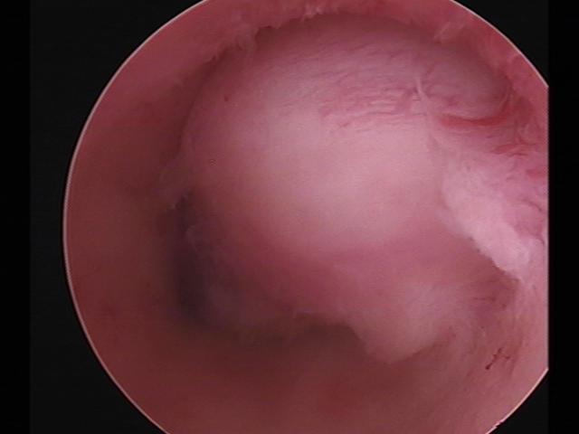 Resectoscopy(16).jpg