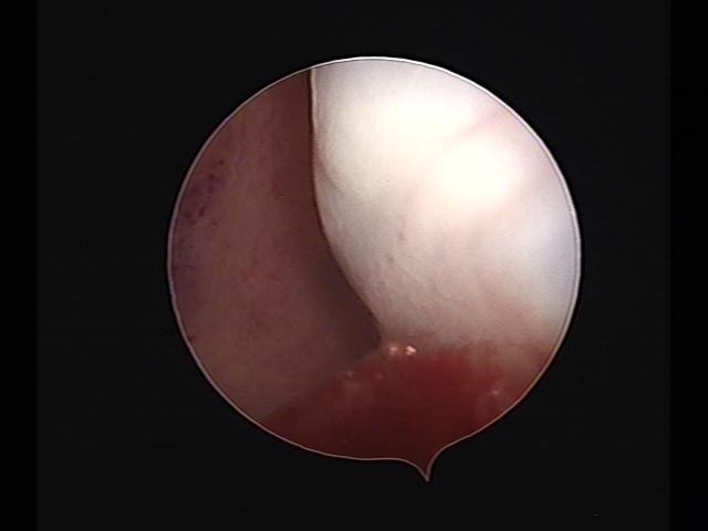 Resectoscopy(26).jpg