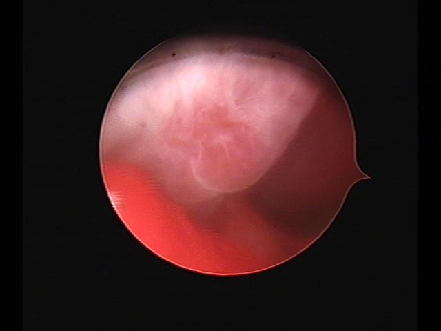 Resectoscopy(31).jpg