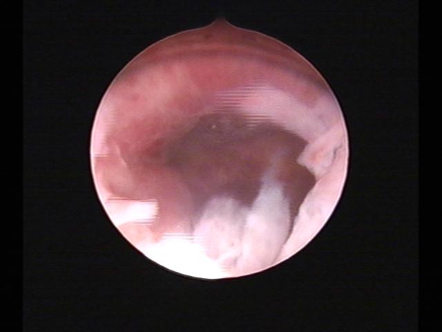 Resectoscopy(33).jpg