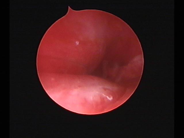 Resectoscopy(42).jpg