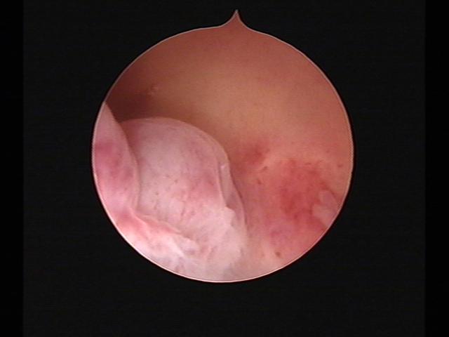 Resectoscopy(45).jpg