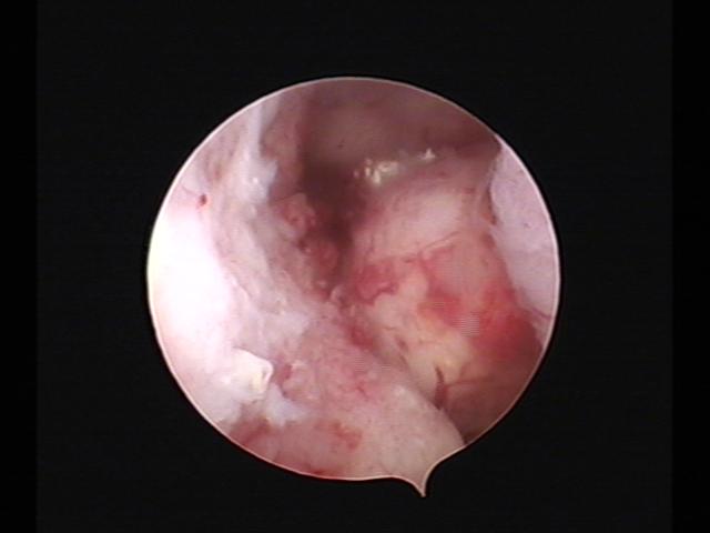 resectoscopy (3)(17).jpg