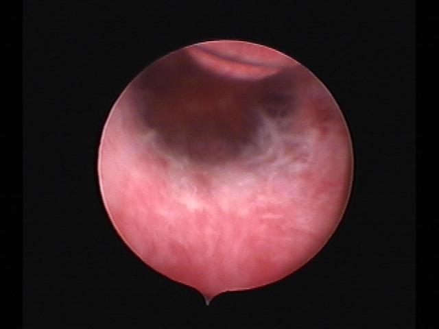 resectoscopy (6)(1).jpg