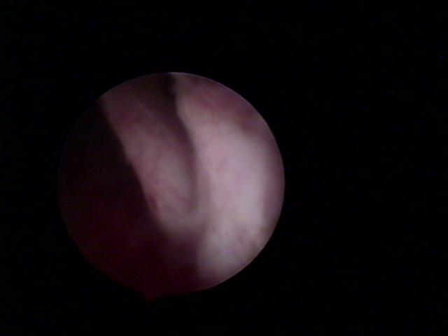 resectoscopy(1).jpg